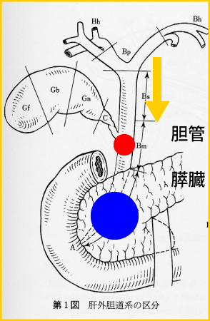 胆管閉塞